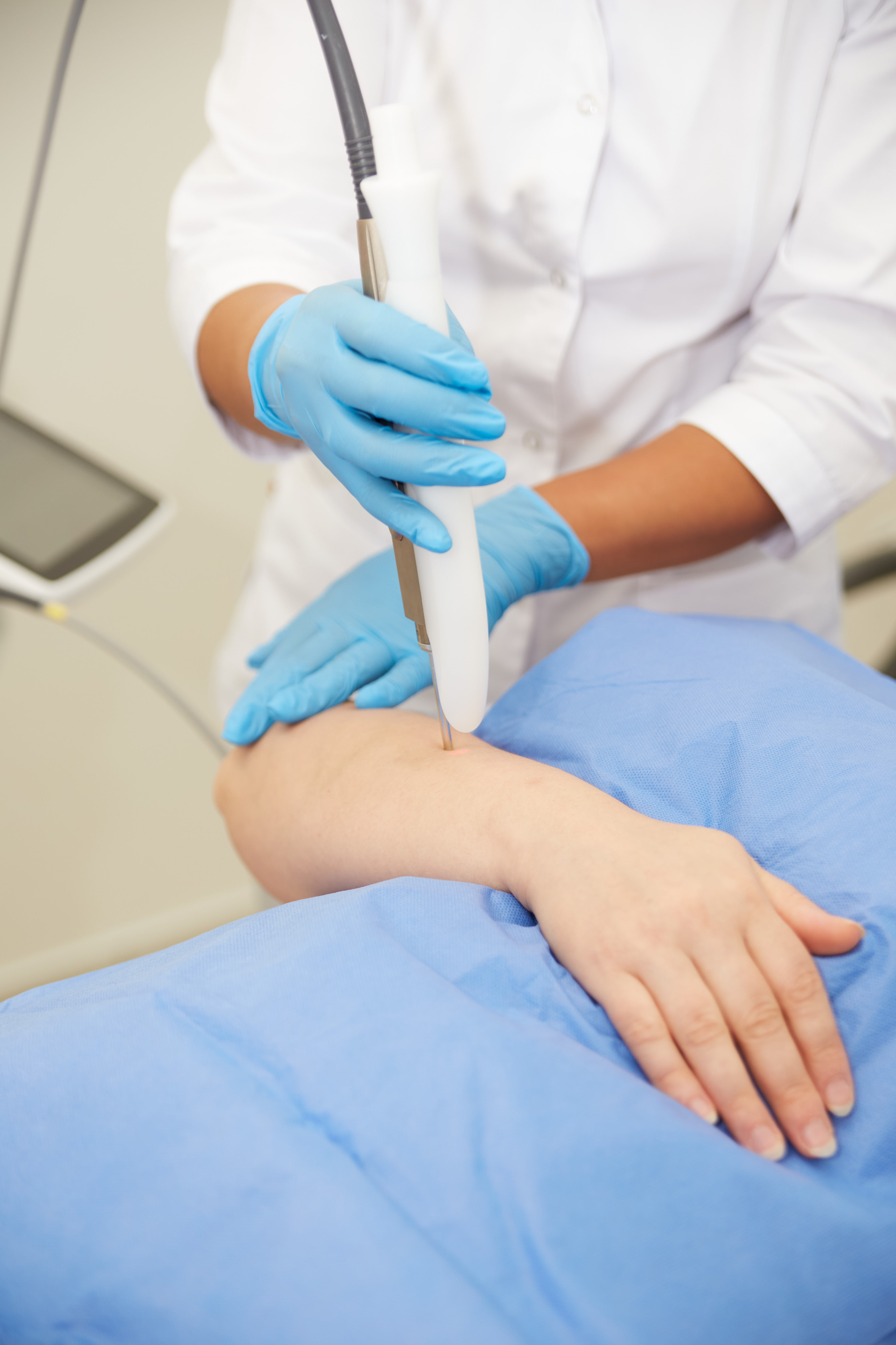 Epilare cu Laser Fotona