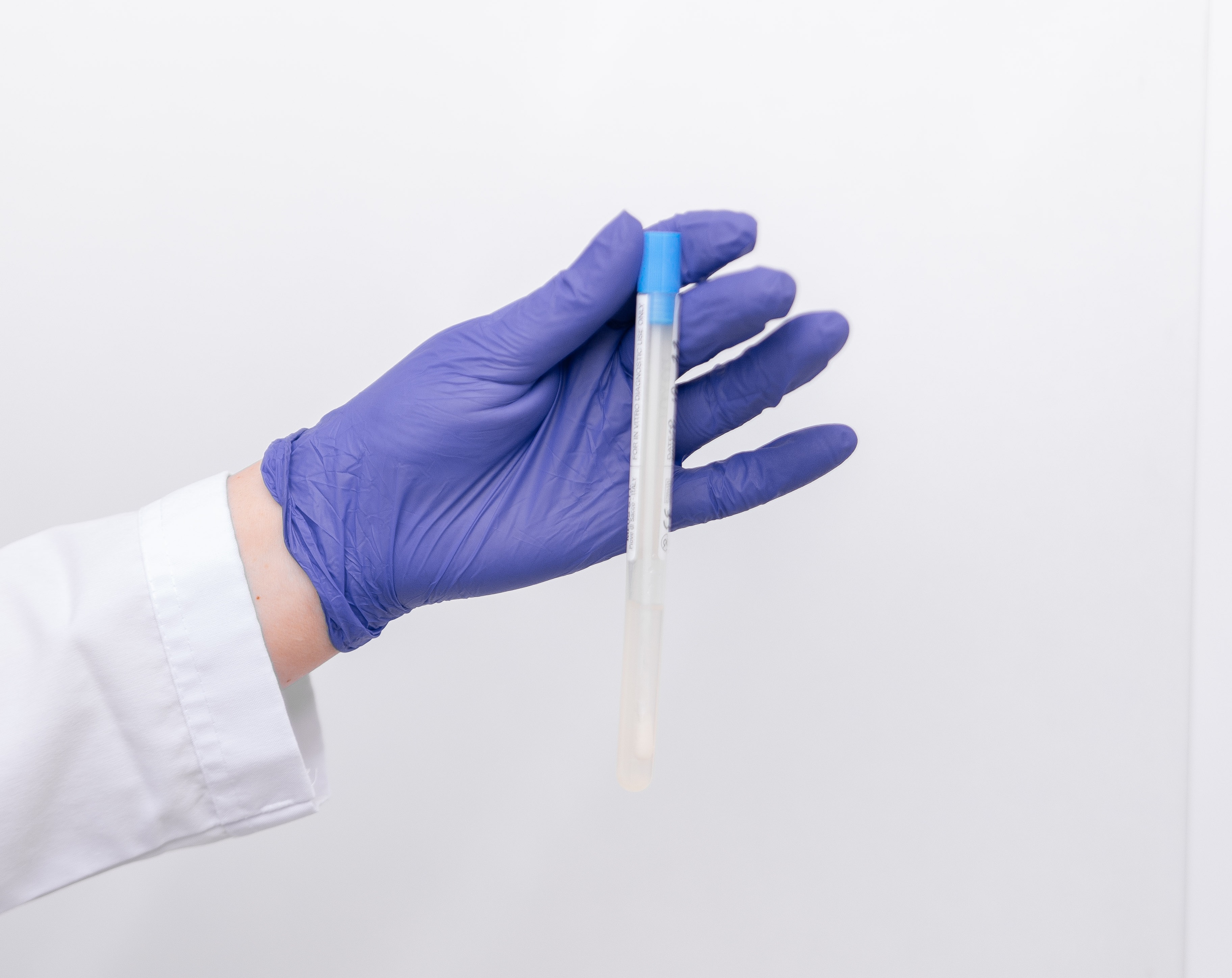 Terapie PRP (Plasmolifting)